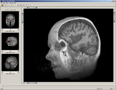3DView screenshot